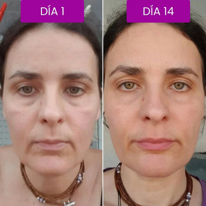 Bálsamo Coreano Dr. Melaxin: Lifting Inmediato